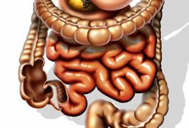How To Treat Crohn's Disease