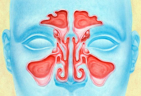 Saline Sinus Flush For Better Health