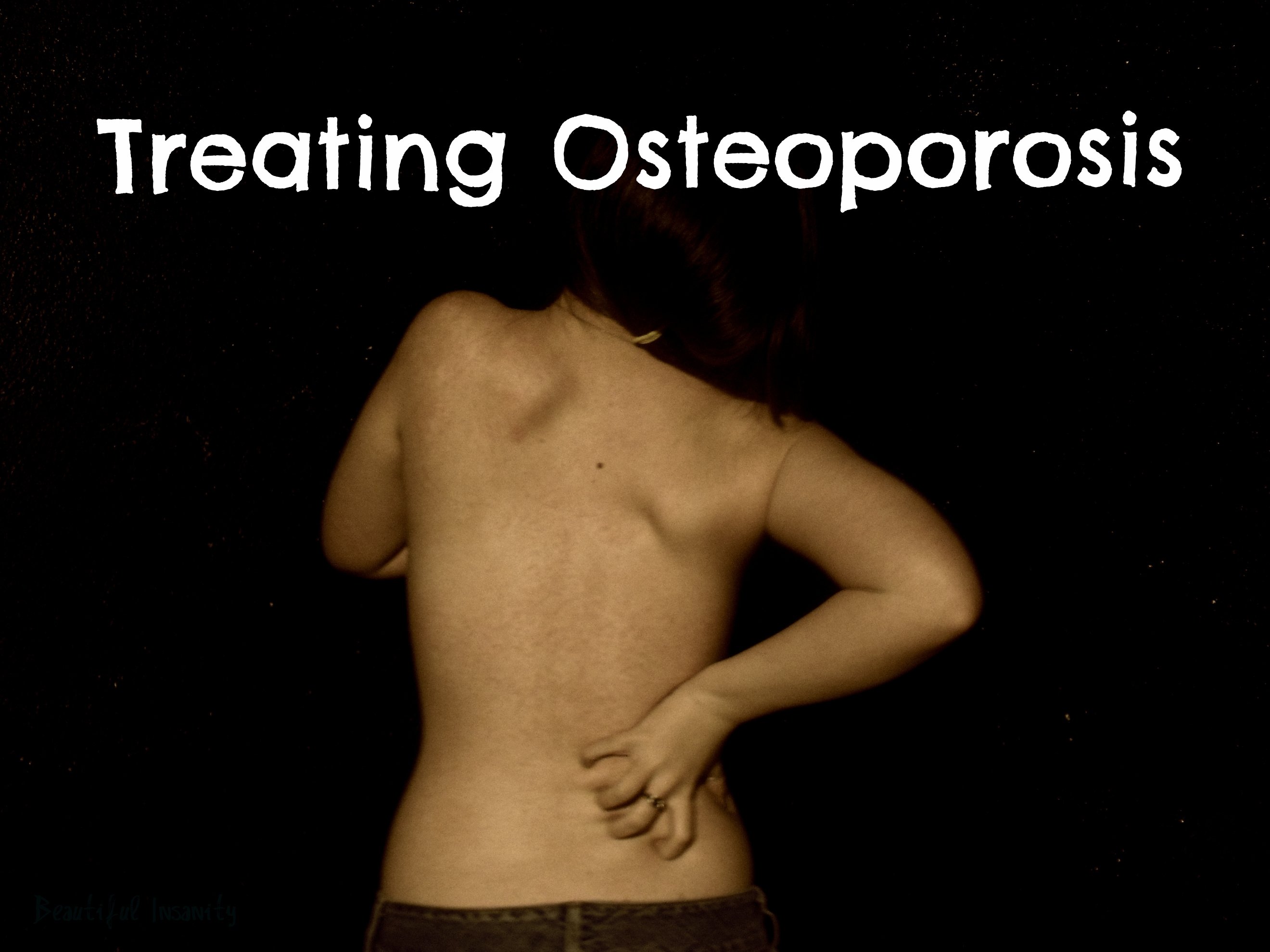 Natural Treatment of Osteoporosis
